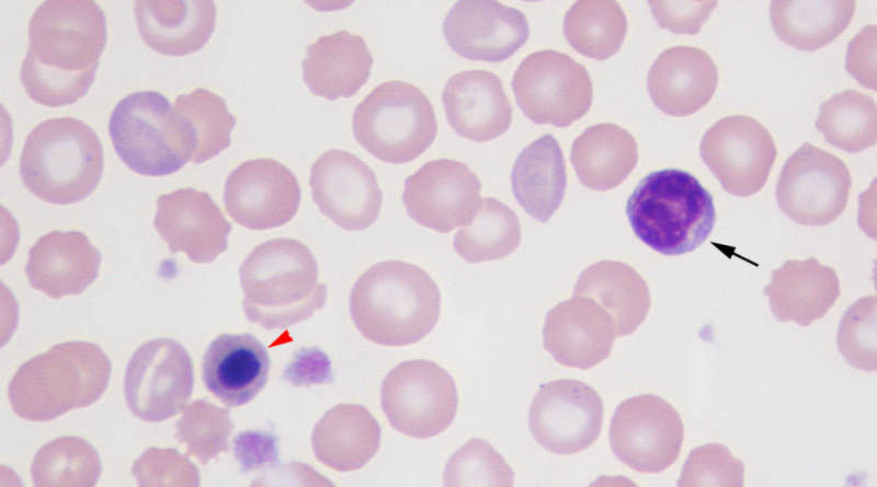 Лимфоциты под микроскопом