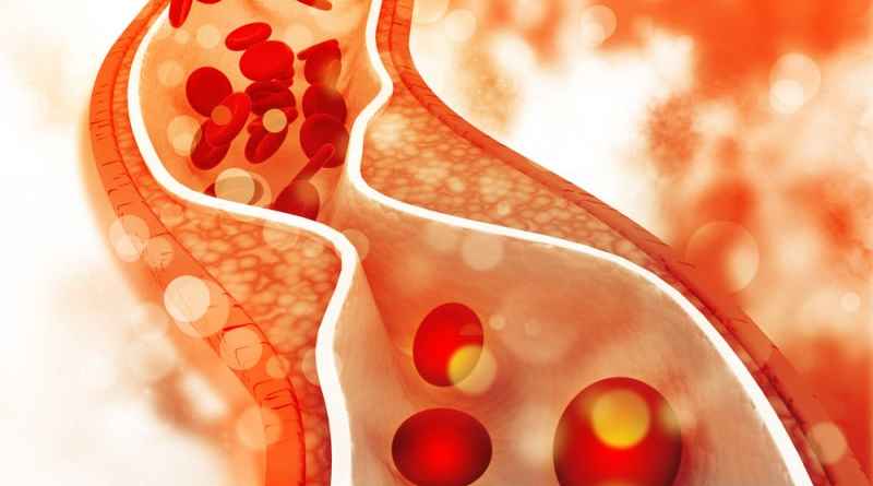 Как спаржа помогает снизить холестерин в крови