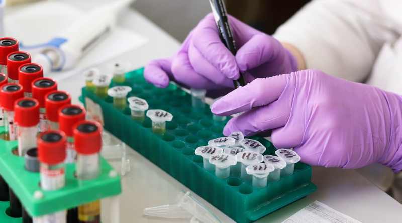 Лаборатория крови - анализ на агрегацию тромбоцитов