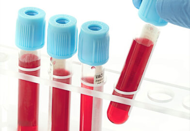 Лейкоциты в крови – норма по полу и возрасту, повышенные и пониженные значения
