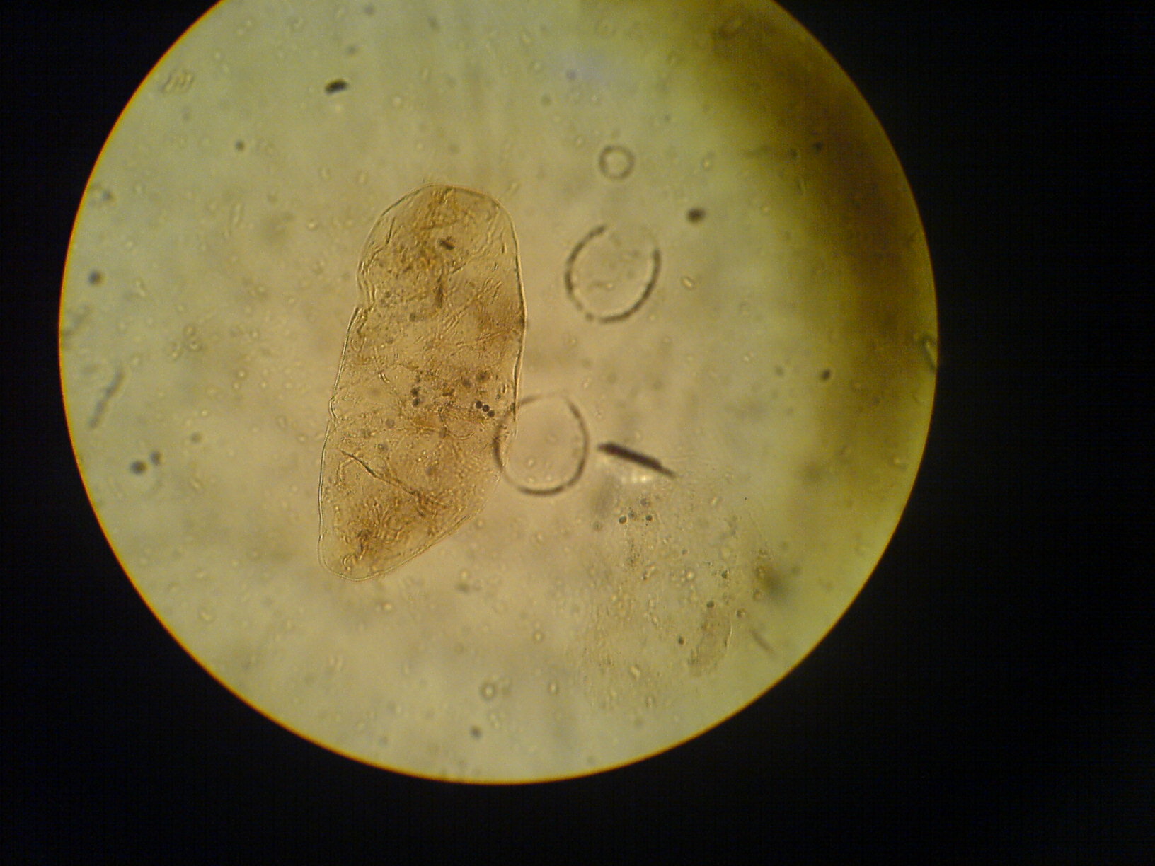 Споры в кале у взрослого. Цисты лямблии микроскопия. Цисты лямблий микроскопия кала. Яйца описторхов под микроскопом. Яйца гельминтов микроскопия.