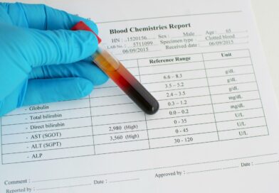 Асат и алат анализ крови – что это, причины повышения, норма у женщин, мужчин, детей